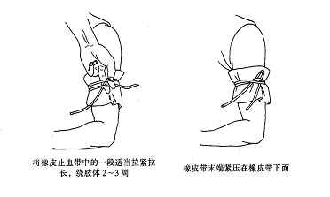 止血带.jpg_表情大全